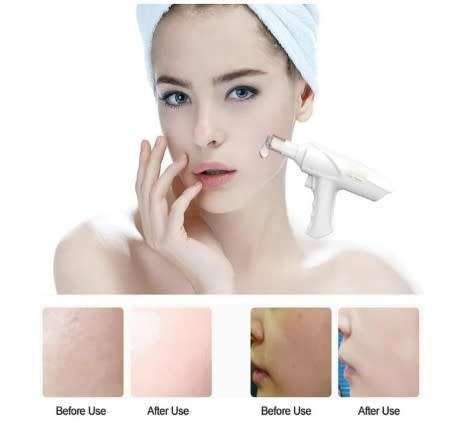 HydraFacial Machine Microcrystalline Mesotherapy Water Mesotherapy Gun Needles Skin Care Home Use
