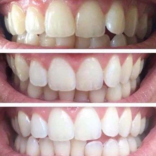AP 24 Whitening Fluoride Toothpaste