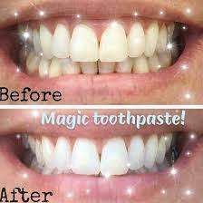 AP 24 Whitening Fluoride Toothpaste - Best Seller.