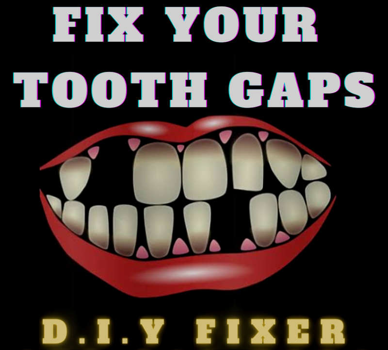 TOOTH GAP DiY Temporary FILLERS - Small Pack
