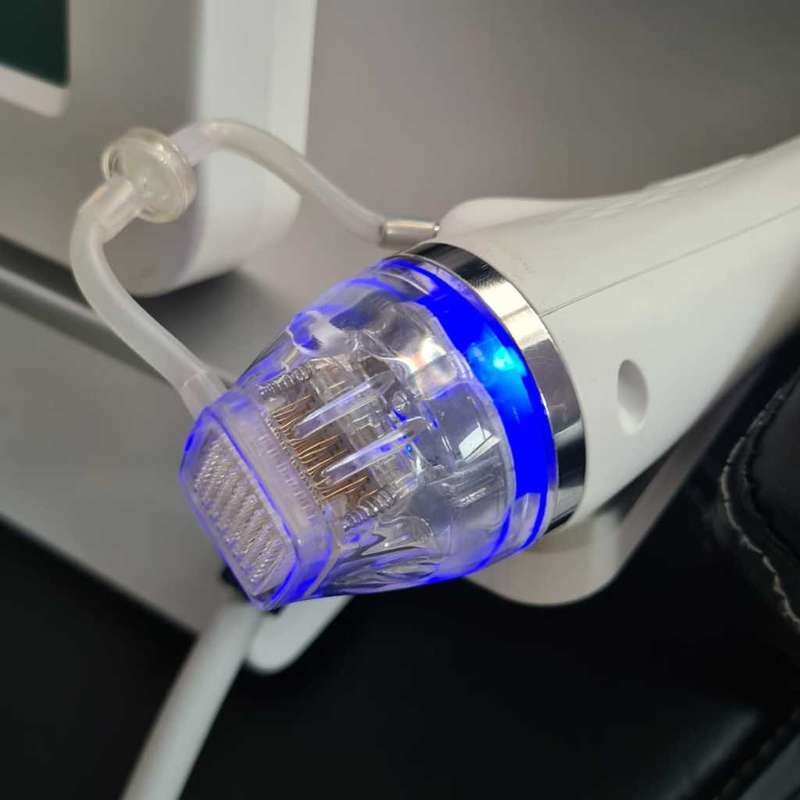 Fractional RF Microneedling Machine for beauty and wellness business.
