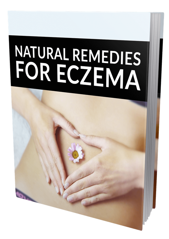 Natural Remedies For Eczema - 36 Pages eBook