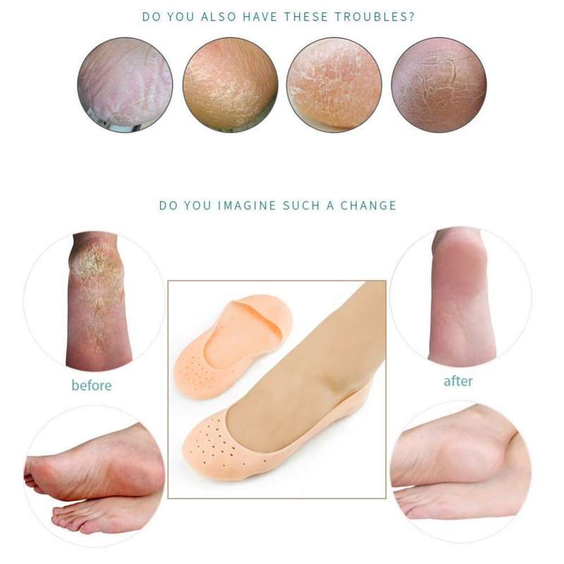 Two Pairs Of Silicone Feet Moisturizing Socks-Care Foot Socks
