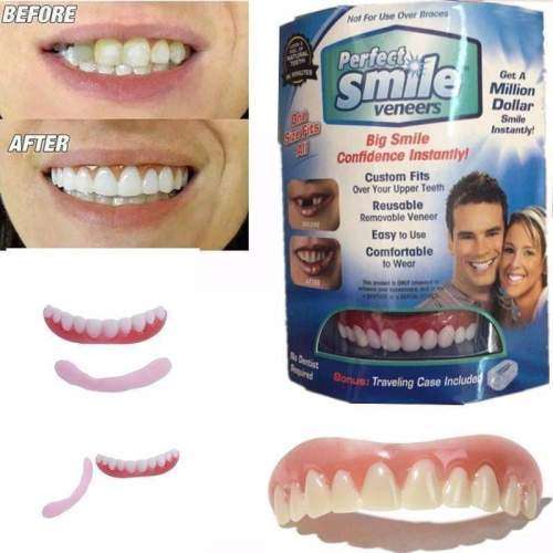Perfect Smile Top Teeth Veneers
