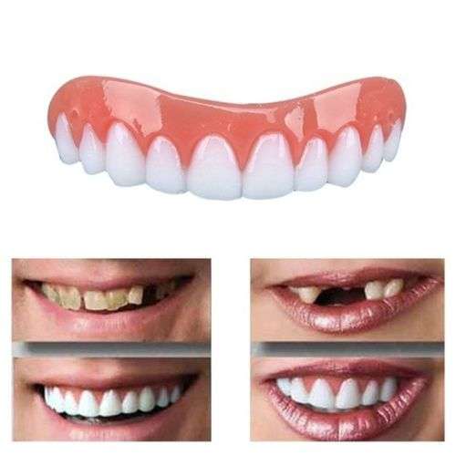 Perfect Smile Top Teeth Veneers