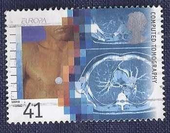 Britain.1994.EUROPA Stamps - Medical Discoveries 41p  Computed Tomography