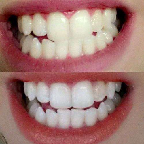 Ap24 whitening toothpaste