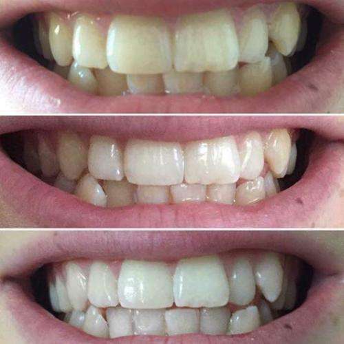 Ap24 whitening toothpaste