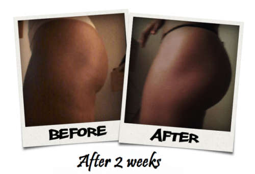 Hips And Bums Enlargement Cream and pills +27738632109 in Bloemfontein, East London