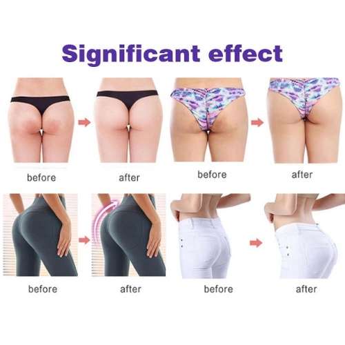 Brilliant Hip Up Buttocks and Hips Firming Cream