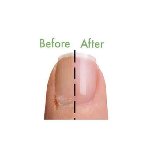 BRILLIANT !!!!!!   5 MINUTE HEALING  NAIL , SKIN and CUTICLE MANI NAIL MASKS  ( 4 Treatment Packs )