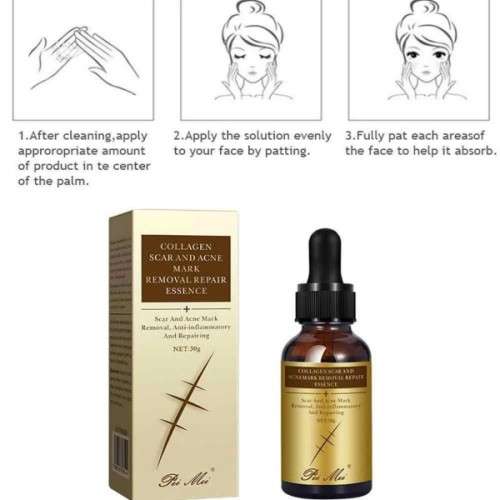 Pei Mei  Collagen  Acne Scar , Burn Scar , Injury Scar and Stretch Marks Repair and Removal Essence