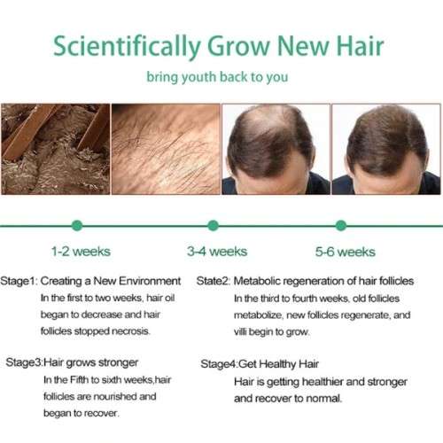 GINGER GERMINAL Anti-hair Loss and Hair Re-Growth Shampoo