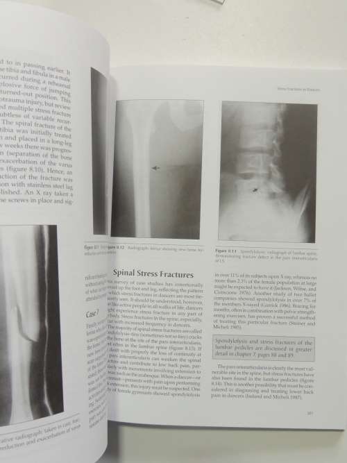 Preventing Dance Injuries - Ruth Solomon, John Solomon, Sandra Cerny Minton