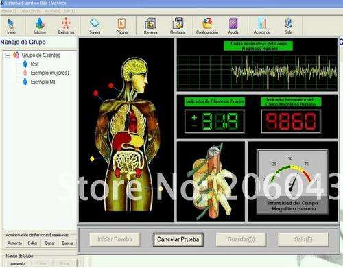 26 reports AE organism analyzer