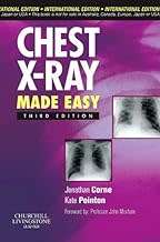 Chest X-Ray Made Easy by Jonathan Corne
