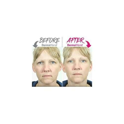 DERMA WANDI WRINKLE SOLUTION