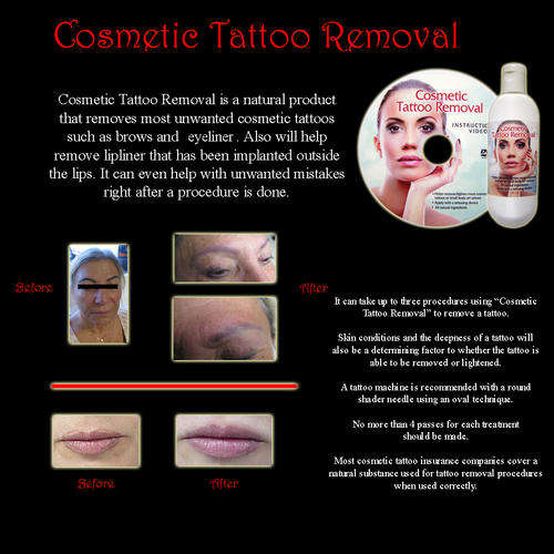 Cosmetic & Tattoo Removal - USA Product