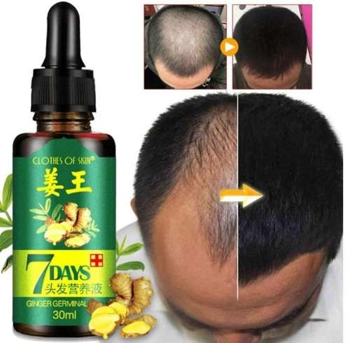 30ml 7 Day Ginger Germinal Serum Essence Oil Natural Hair Loss Treatement