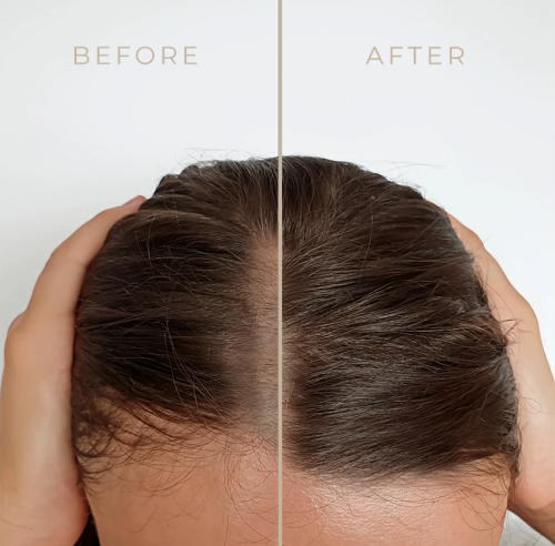 Rosemary Water For Hair Growth 50ml
