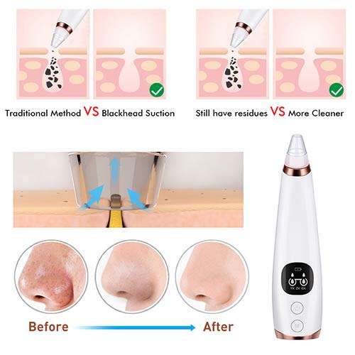 Blackhead Remover