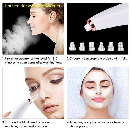 Blackhead Remover