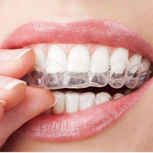 4 piece Anti Snore Snoring Bruxism Sleeping Mouth Guard Tray Gum Shield **LOCAL STOCK**