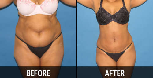 Salon Bulk Pack - Covers 30 Wraps - Lose 25cm FAT per SESSION! Start your own SALON!