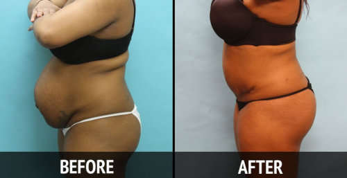 13 Day Diet Program - Shake off up to 7kg! Just in two weeks!