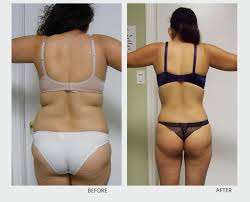 For a slimmer waistline and firm skin, Lose up to 20cm's in ONE HOUR!! This really does work.