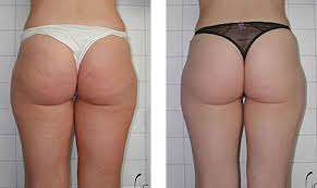 Speed up your metabolism! 3 Months Supply, Get Ready For Summer Now!!