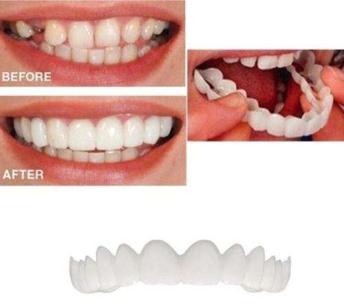 Comfort Fit Flex Cosmetic Teeth for top or bottom