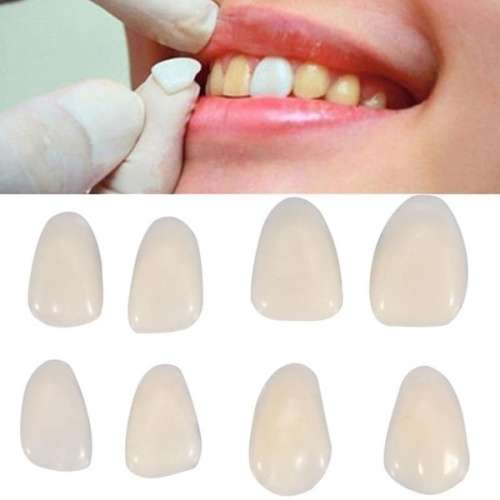 50Pcs Dental Temporary Crowns Resin Porcelain Materials
