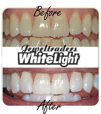 JT - LASER LIGHT Home Teeth Whitening System 10 minutes