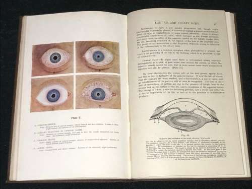 THE RECOGNITION OF OCULAR DISEASE BY JAMES FORREST 6TH EDITION