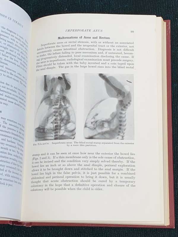 PROGRESS IN CLINICAL SURGERY BY VARIOUS AUTHORS 1954