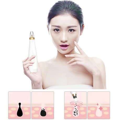 Electric Vacuum Facial Blackhead Remover