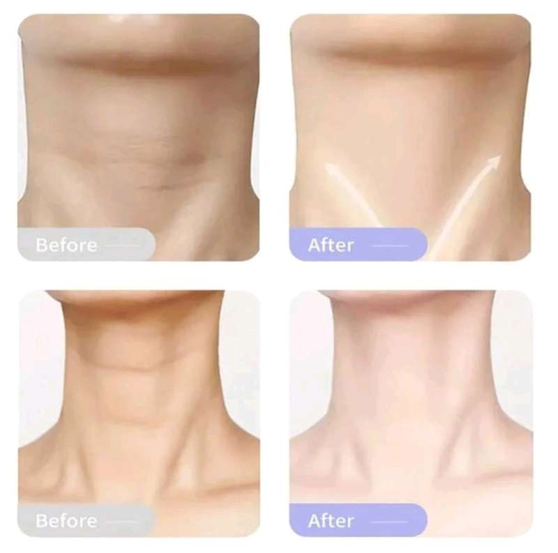TRSTAY Intensive Wrinkle Repair with Body Serum Lighten