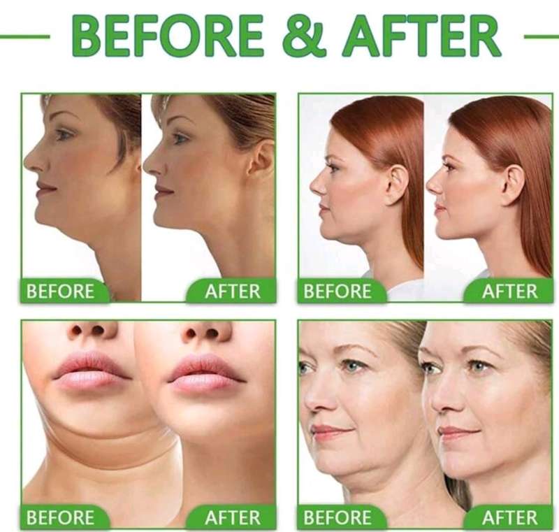 TRSTAY Intensive Wrinkle Repair with Body Serum Lighten