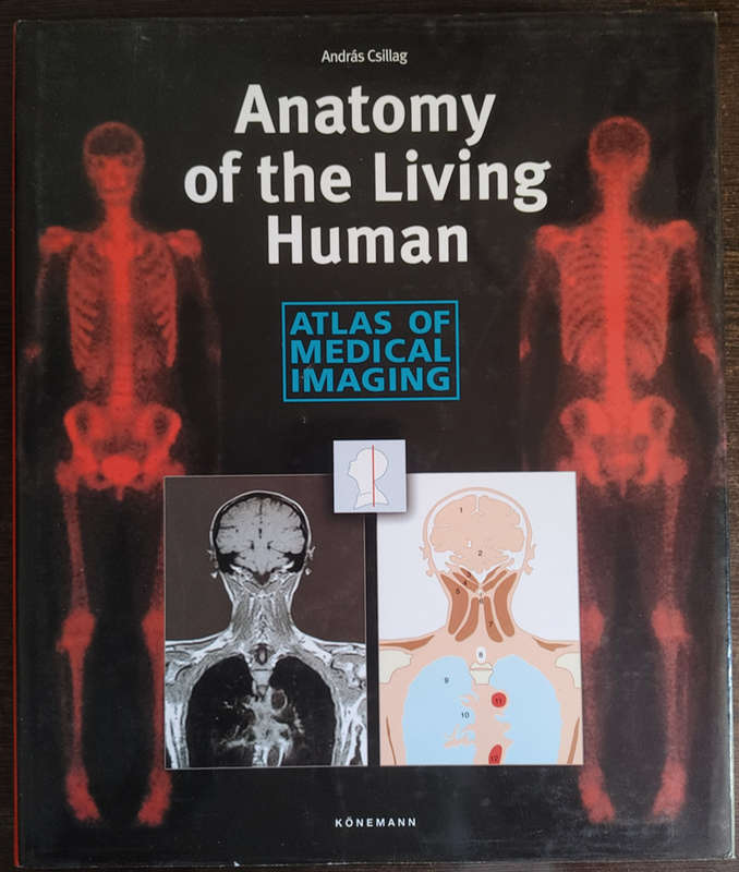Anatomy of the Living Human: Atlas of Medical Imaging by Andras Csillag - HARD COVER