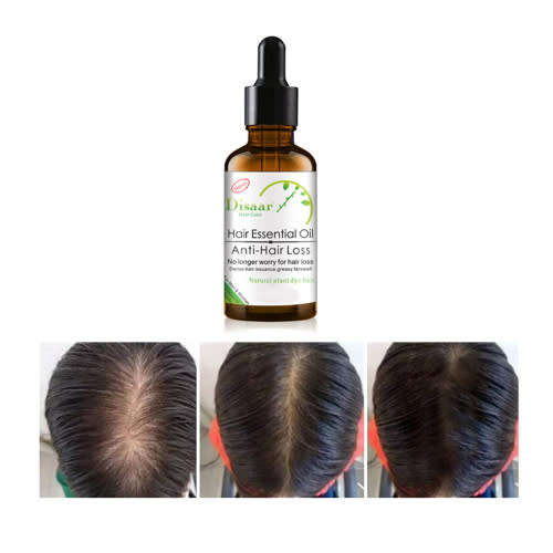 Anti Hair Loss Shampoo & Oil Combo