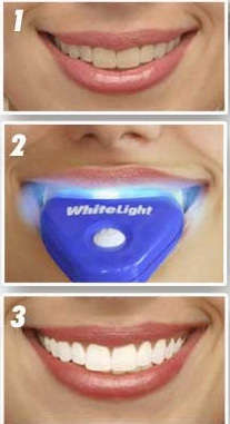 WHITE LIGHT TEETH WHITENING SYSTEM - TEETH WHITENING 