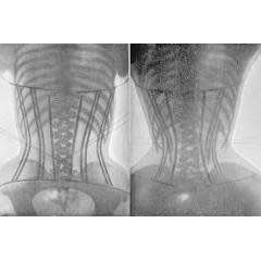 HOT WAIST TRIMMER