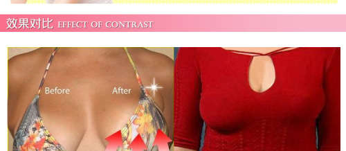 Bare lifts instant breast lift tape skin tape#local stock#