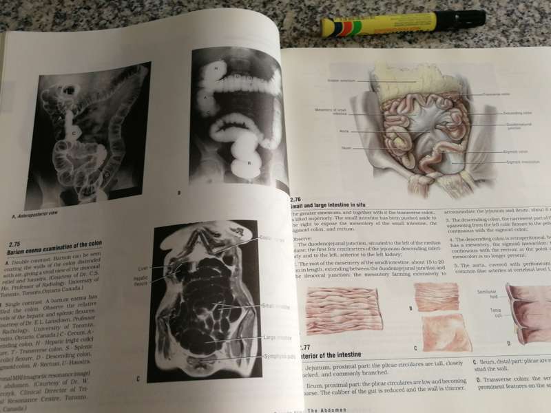 ATLAS OF ANATOMY NINETH EDITION ANNE M R AGUR ( human body dissecting reference )