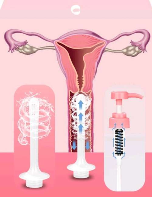 Female Gynecological Hygiene Kit (Douche) Reusable