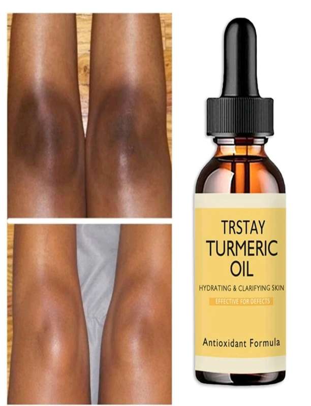 Skin Whitening Tumeric Oil (50ml)