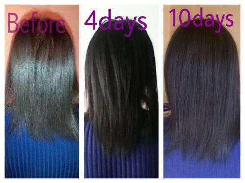 Xtreme Hair growth tonic 200ml