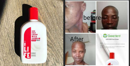 SOD Face Cream