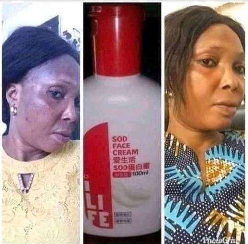 SOD Face Cream